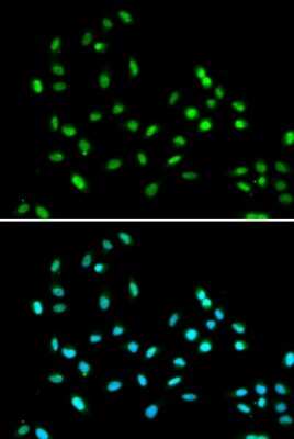 Immunocytochemistry/ Immunofluorescence: SMARCAD1 Antibody - BSA Free [NBP2-94459]