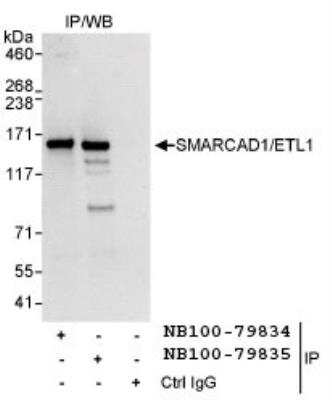 Immunoprecipitation: SMARCAD1 Antibody [NB100-79834]