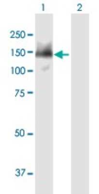 Western Blot: SMARCAD1 Antibody [H00056916-B01P]