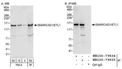 Western Blot: SMARCAD1 Antibody [NB100-79835]