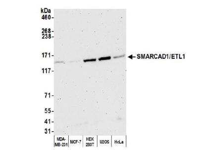 Western Blot: SMARCAD1 Antibody [NB100-79835]