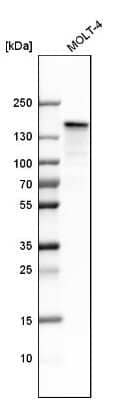 Western Blot: SMARCAD1 Antibody [NBP1-85023]