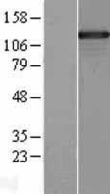 Western Blot: SMARCAD1 Overexpression Lysate [NBL1-16229]