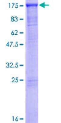 SDS-PAGE: Recombinant Human SMARCAD1 GST (N-Term) Protein [H00056916-P01]