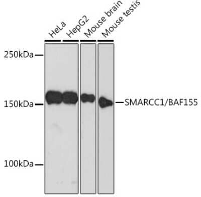 Western Blot: SMARCC1 Antibody (1R7I6) [NBP3-16367]