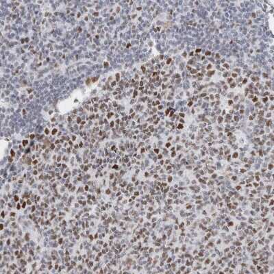 Immunohistochemistry-Paraffin: SMARCC1 Antibody [NBP1-88720]