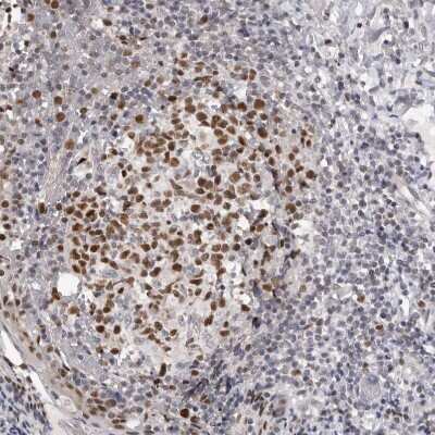 Immunohistochemistry: SMARCC1 Antibody [NBP1-88721]