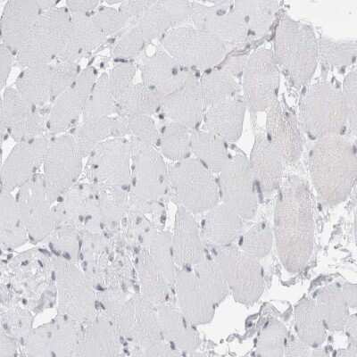 Immunohistochemistry-Paraffin: SMARCC1 Antibody [NBP1-88720]
