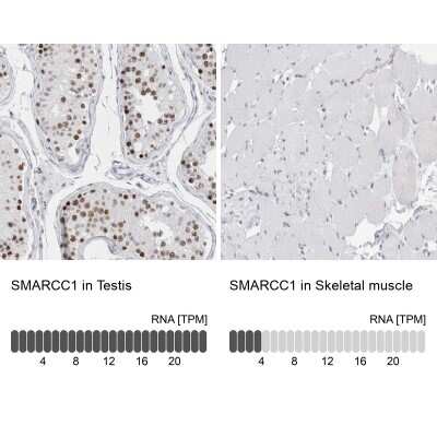 Immunohistochemistry-Paraffin: SMARCC1 Antibody [NBP1-88720]