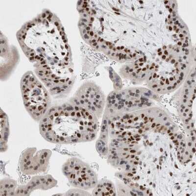 Immunohistochemistry-Paraffin: SMARCC1 Antibody [NBP1-88720]