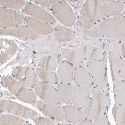 Immunohistochemistry-Paraffin: SMARCC1 Antibody [NBP1-88721]