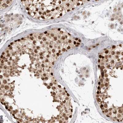 Immunohistochemistry-Paraffin: SMARCC1 Antibody [NBP1-88721]