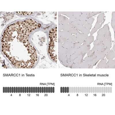 Immunohistochemistry-Paraffin: SMARCC1 Antibody [NBP1-88721]