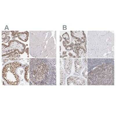Immunohistochemistry-Paraffin: SMARCC1 Antibody [NBP1-88721]