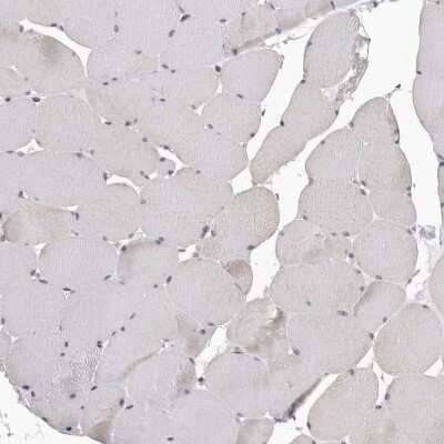 Immunohistochemistry-Paraffin: SMARCC1 Antibody [NBP1-88721]