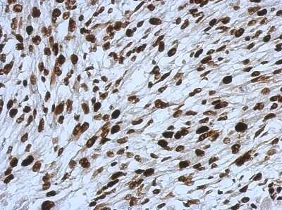 Immunohistochemistry-Paraffin: SMARCC1 Antibody [NBP2-20415]