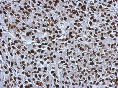 Immunohistochemistry-Paraffin: SMARCC1 Antibody [NBP2-20415]