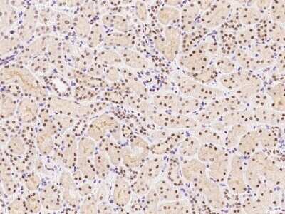 Immunohistochemistry-Paraffin: SMARCC1 Antibody [NBP2-98777]