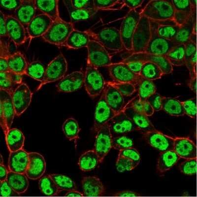 Immunocytochemistry/ Immunofluorescence: SMARCC1 Antibody (PCRP-SMARCC1-1F1) [NBP3-07623]