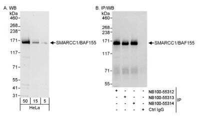 Western Blot: SMARCC1 Antibody [NB100-55312]