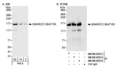 Western Blot: SMARCC1 Antibody [NB100-55314]