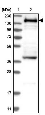 Western Blot: SMARCC1 Antibody [NBP1-88720]