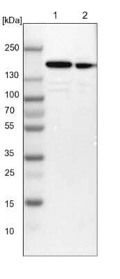 Western Blot: SMARCC1 Antibody [NBP1-88720]