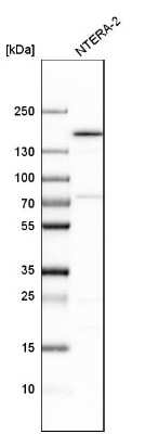 Western Blot: SMARCC1 Antibody [NBP1-88721]