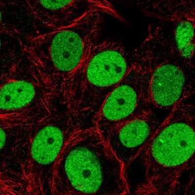 Immunocytochemistry/ Immunofluorescence: SMARCC2/BAF170 Antibody [NBP2-57277]