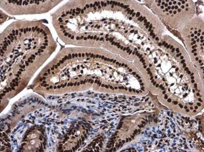 Immunohistochemistry-Paraffin: SMARCC2/BAF170 Antibody [NBP3-12872]
