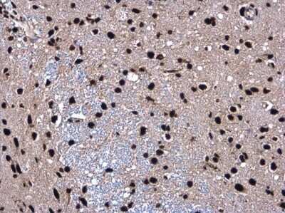Immunohistochemistry-Paraffin: SMARCC2/BAF170 Antibody [NBP3-12872]