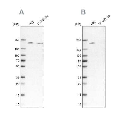 Western Blot: SMARCC2/BAF170 Antibody [NBP1-90017]