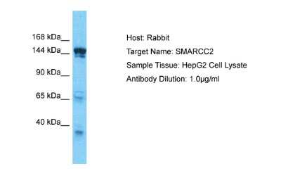 Western Blot: SMARCC2/BAF170 Antibody [NBP2-85775]