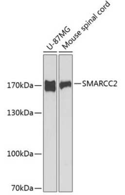 Western Blot: SMARCC2/BAF170 AntibodyBSA Free [NBP2-93679]