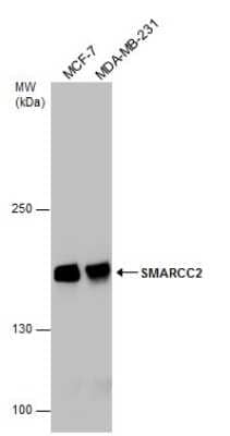 Western Blot: SMARCC2/BAF170 Antibody [NBP3-12872]