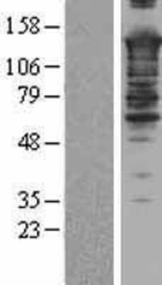 Western Blot: SMARCC2/BAF170 Overexpression Lysate [NBL1-16232]