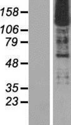 Western Blot: SMARCC2/BAF170 Overexpression Lysate [NBP2-11321]