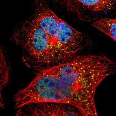 Immunocytochemistry/ Immunofluorescence: SMARCD1 Antibody [NBP1-88719]