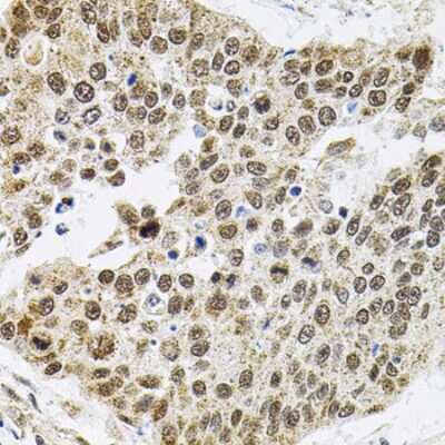 Immunohistochemistry-Paraffin: SMARCD1 Antibody - BSA Free [NBP2-94195]
