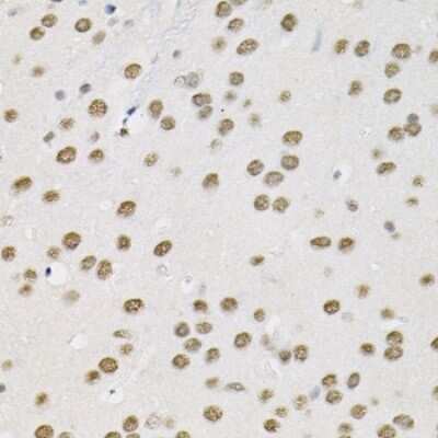 Immunohistochemistry-Paraffin: SMARCD1 Antibody - BSA Free [NBP2-94195]