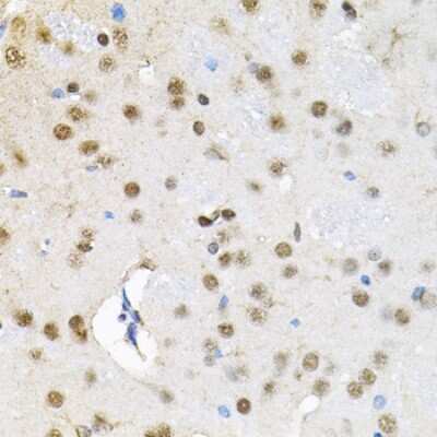 Immunohistochemistry-Paraffin: SMARCD1 Antibody - BSA Free [NBP2-94195]