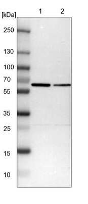 Western Blot: SMARCD1 Antibody [NBP1-88719]