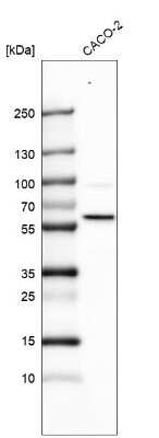 Western Blot: SMARCD1 Antibody [NBP1-88719]