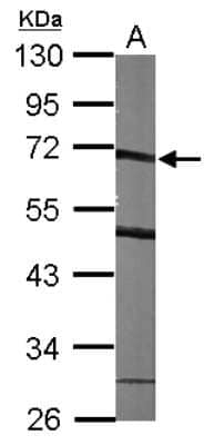 Western Blot: SMARCD1 Antibody [NBP2-20417]