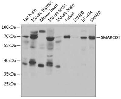 Western Blot: SMARCD1 AntibodyBSA Free [NBP2-93825]