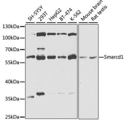 Western Blot: SMARCD1 AntibodyBSA Free [NBP2-94195]