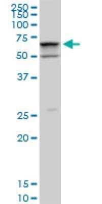 Western Blot: SMARCD2 Antibody (2B2) [H00006603-M02]
