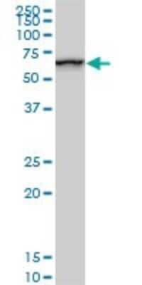 Western Blot: SMARCD2 Antibody (2B2) [H00006603-M02]