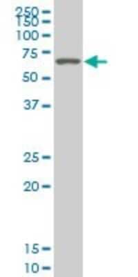 Western Blot: SMARCD2 Antibody (2B2) [H00006603-M02]