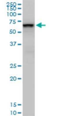 Western Blot: SMARCD2 Antibody (2B2) [H00006603-M02]